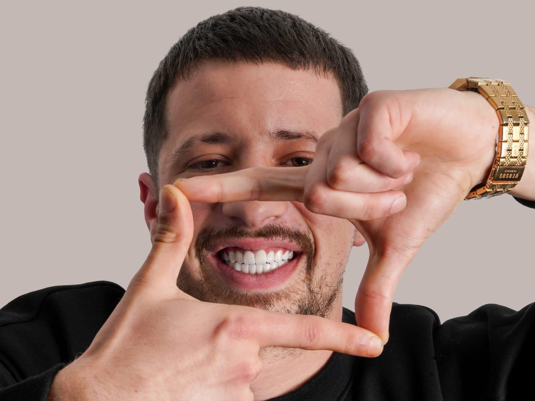 Veneers patient from Belfast