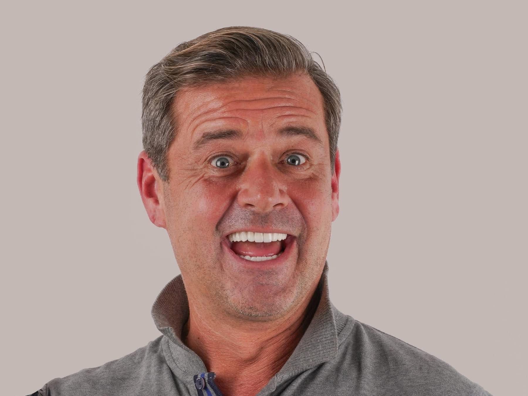 Hollywood Smile patient from Leicester