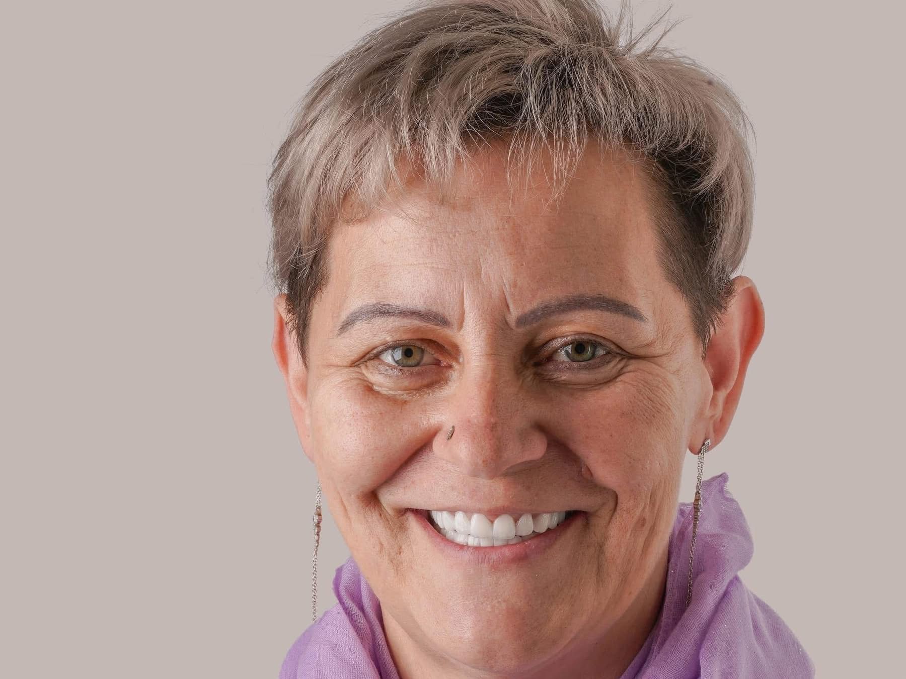Dental Implants patient from Edinburgh