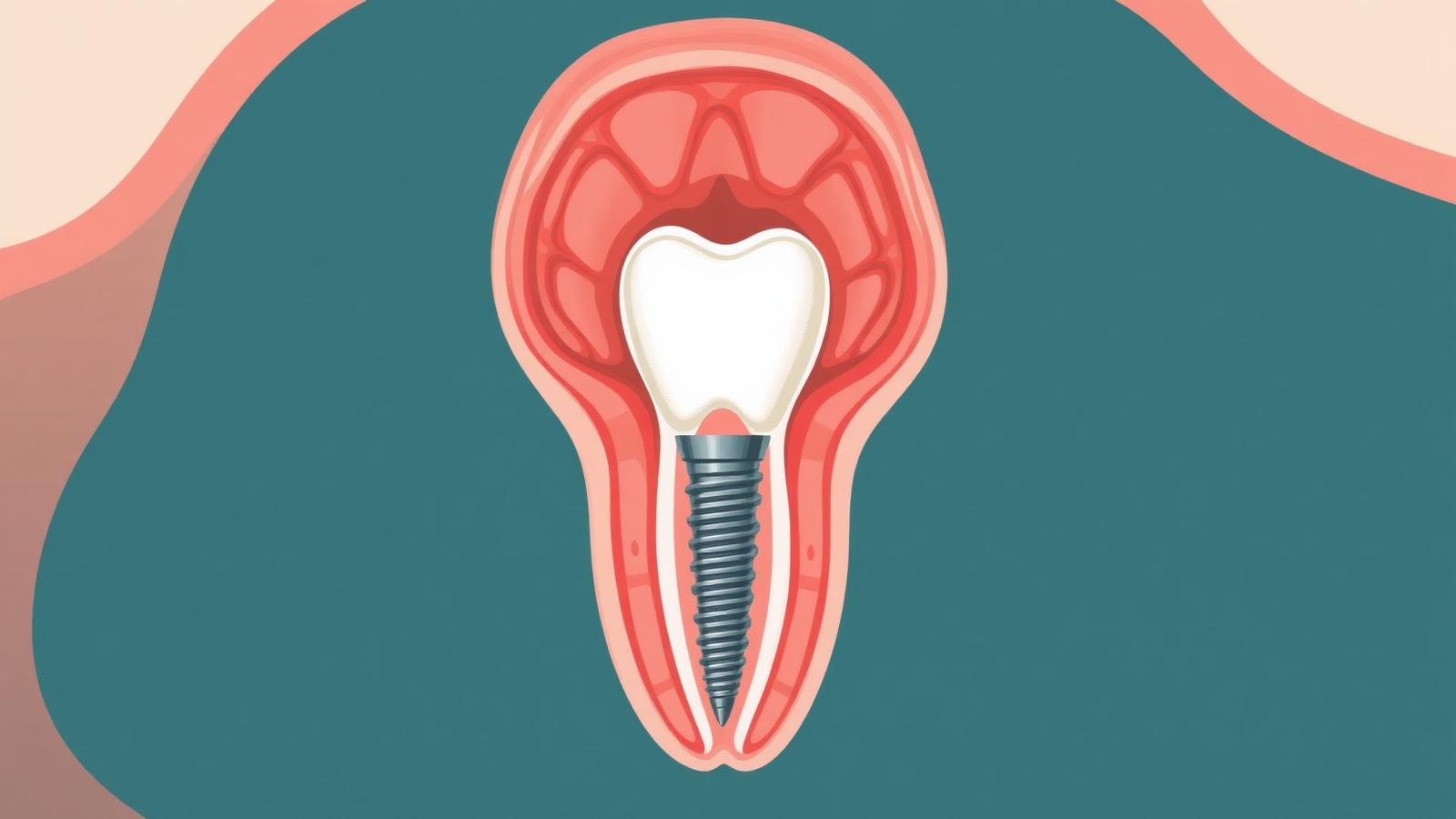 Clinical illustration of post-treatment dental infection presentations including peri-implant inflammation and periapical abscess.